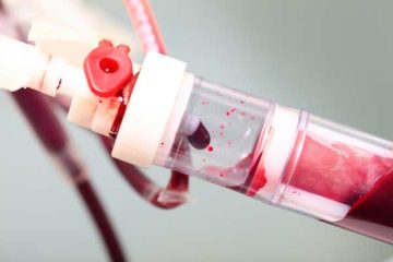 blood-transfusion-1-1024x685